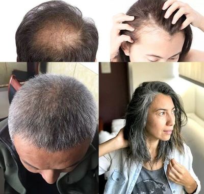 洗頭水中撒一把，頭發長得又快又茂密，白發都沒了！